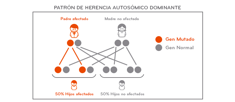 Modelo genético del glaucoma ¿Es hereditario el glaucoma?