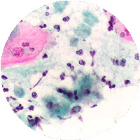 Trichomona-vaginalis
