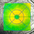 Tomografía óptica de coherencia - Diagnóstico del glaucoma