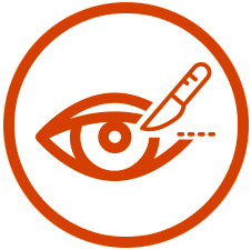 cirugía ocular - oftalmología
