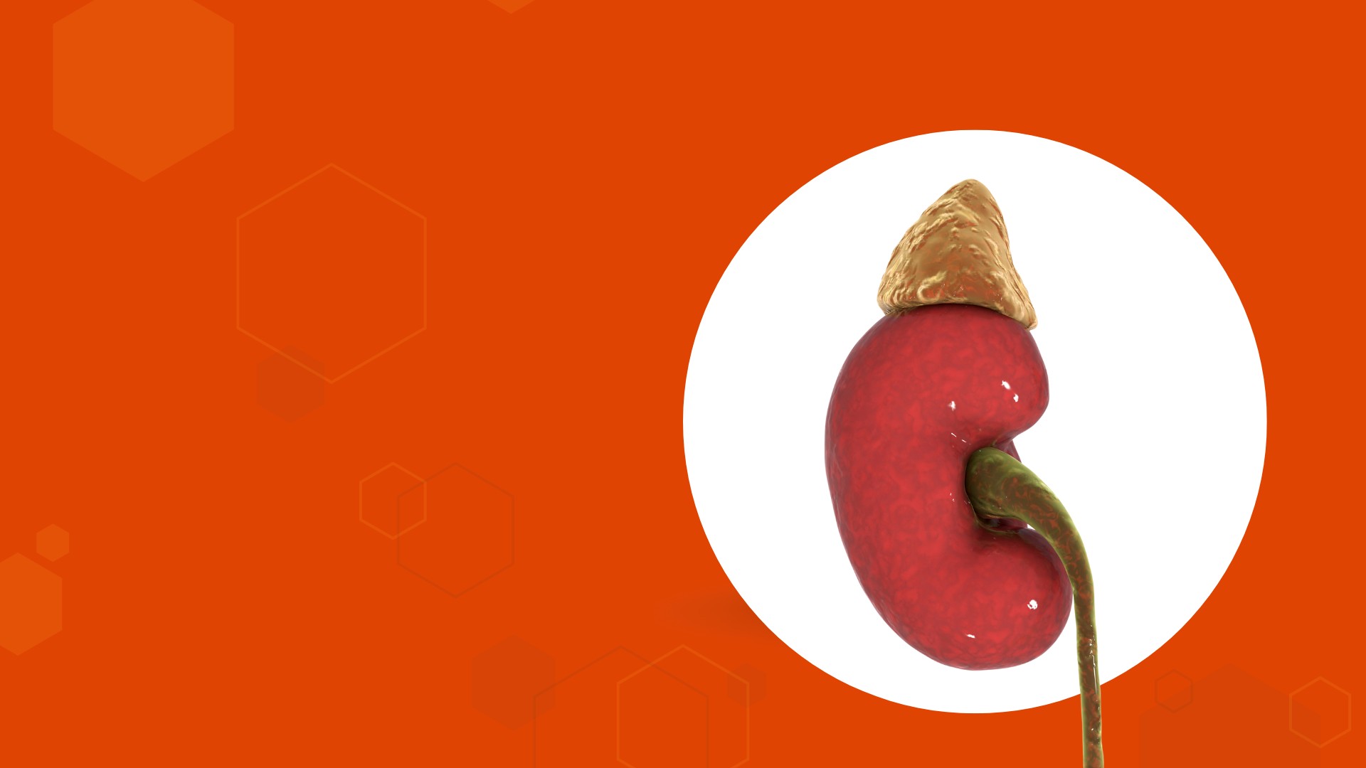 glandula suprarrenal tumor​