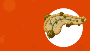 Tumor neuroendocrino del páncreas