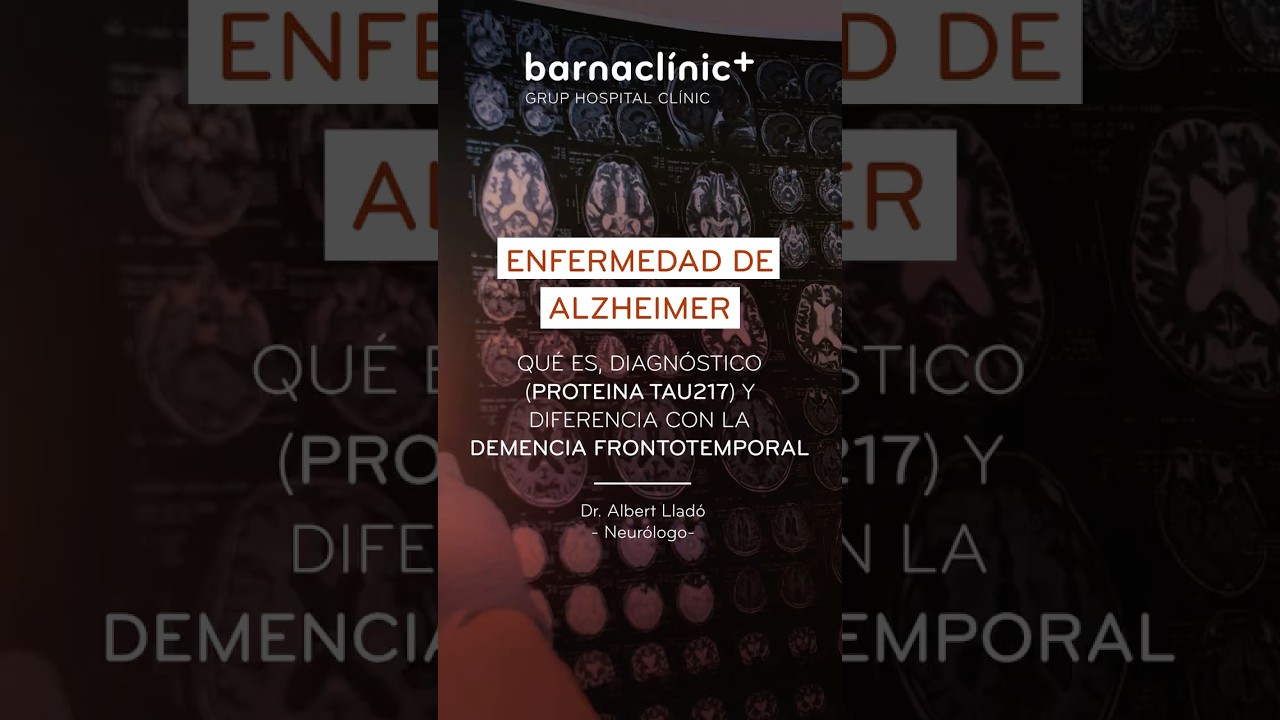 Enfermedad de alzheimer