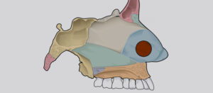 Perforación del tabique nasal - Perforació del septe nasal