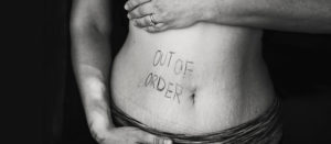 hernia paraestomal - Hèrnia paraestomal