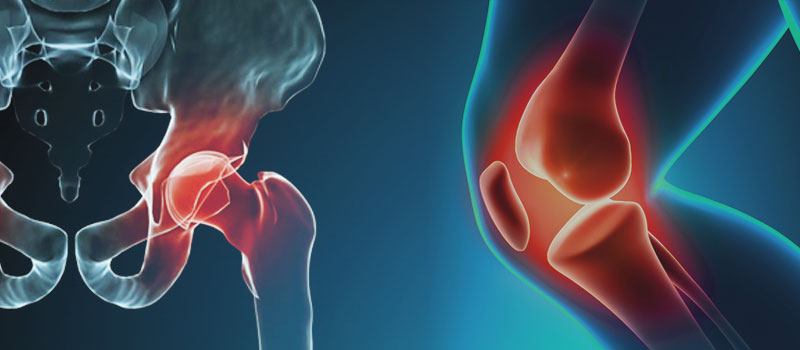 Infección de prótesis de cadera o de rodilla