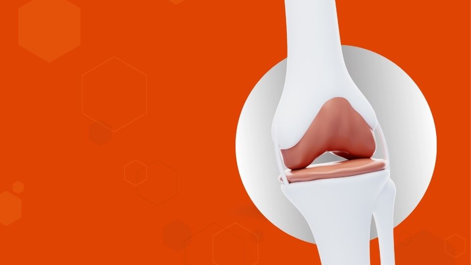 Operación de prótesis de rodilla