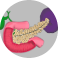 Pancreatitis crónica