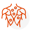 Síndrome miofascial