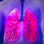 Hipertensión pulmonar - Neumología